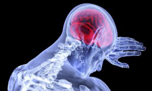 rappresentazione della sindrome da burnout con stress mentale ed esaurimento emotivo