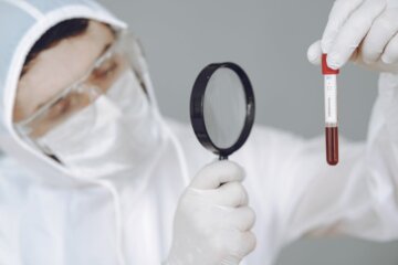 catena epidemiologica