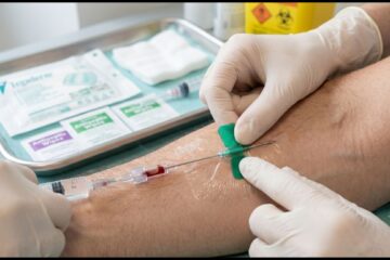 ago cannula utilizzato in ambito sanitario per accesso venoso e assistenza al paziente