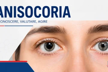 anisocoria con pupille di dimensioni diverse