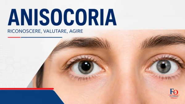 anisocoria con pupille di dimensioni diverse