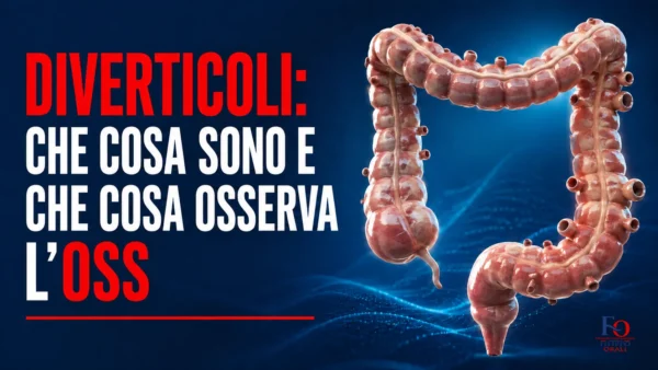 diverticoli del colon rappresentati in un’immagine sanitaria professionale