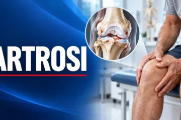 Persona con artrosi al ginocchio assistita mentre si alza dalla sedia